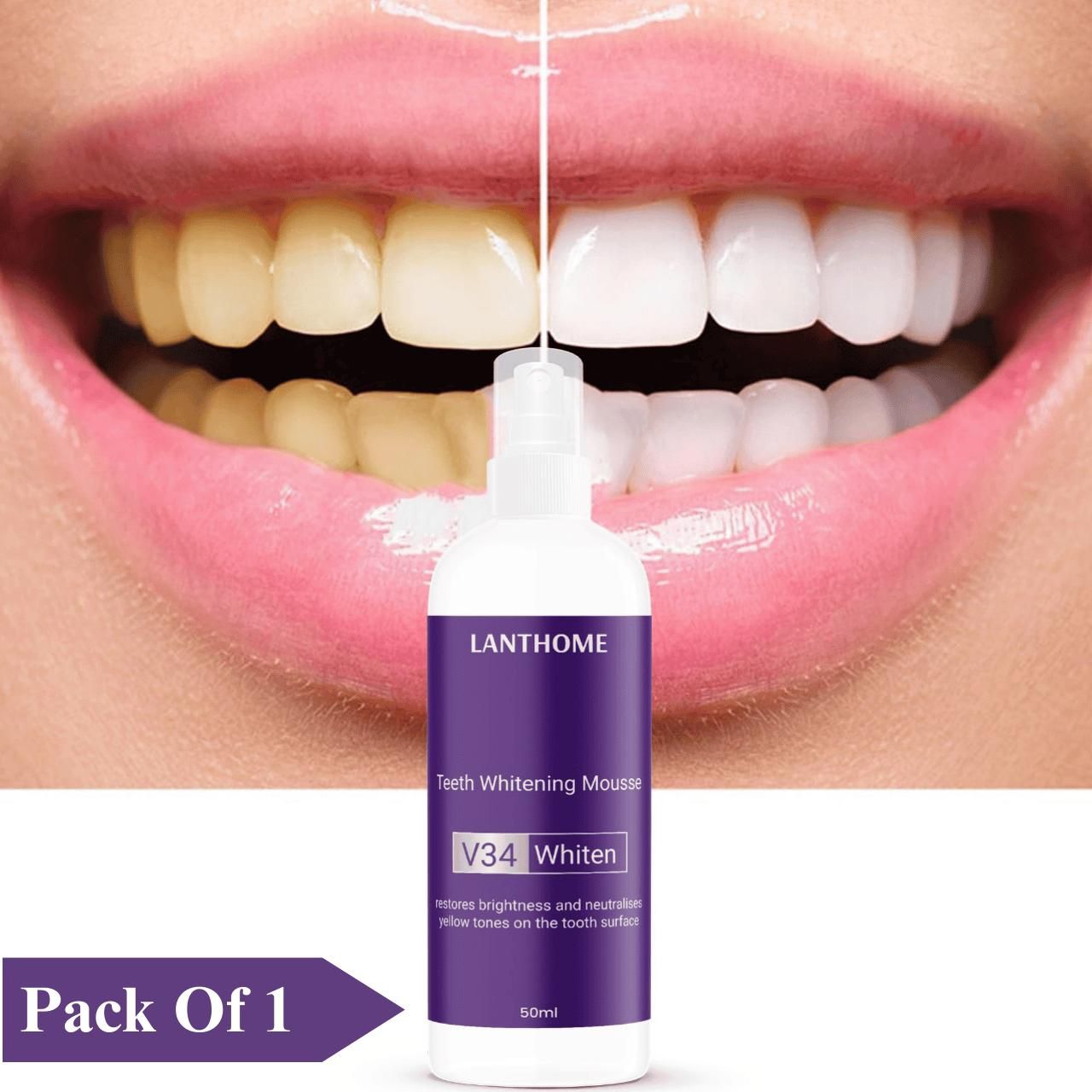 V34 Teeth Whitening Mousse (Pack of 1 – 50ml)