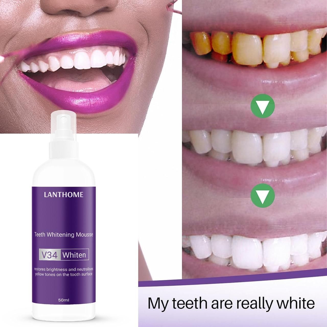 V34 Teeth Whitening Mousse (Pack of 1 – 50ml)