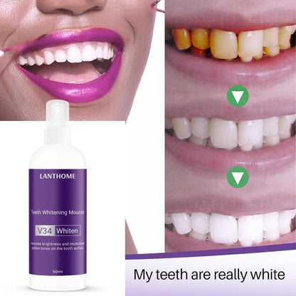 V34 Teeth Whitening Mousse (Pack of 1 – 50ml)