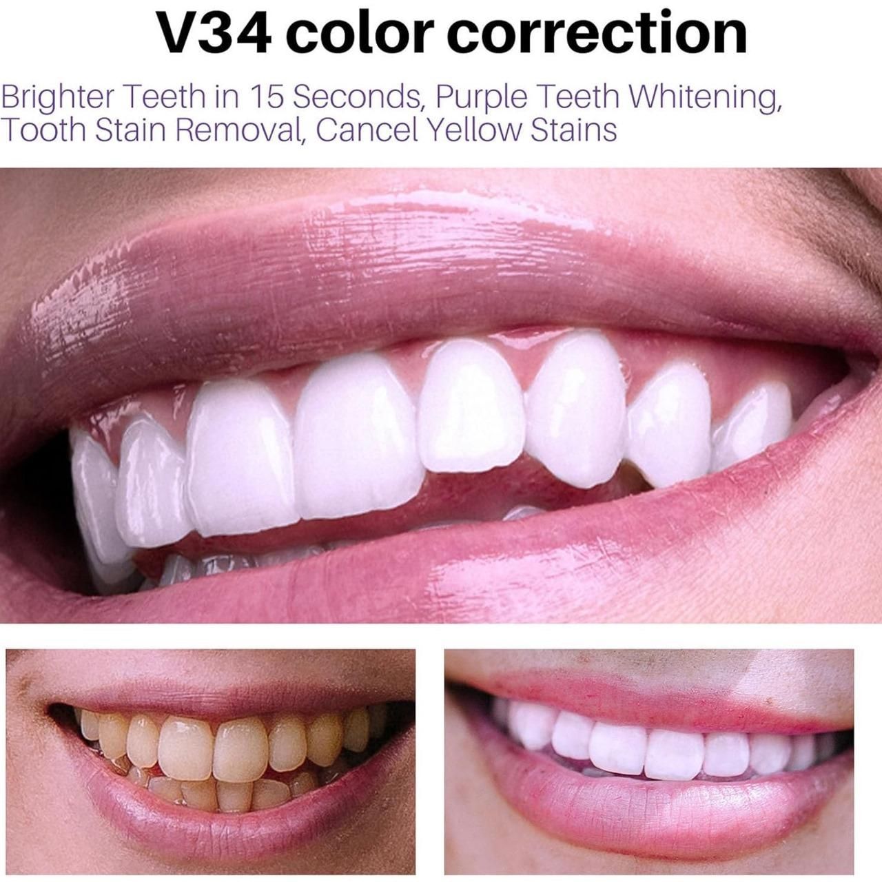 V34 Teeth Whitening Mousse (Pack of 1 – 50ml)