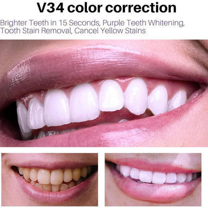 V34 Teeth Whitening Mousse (Pack of 1 – 50ml)